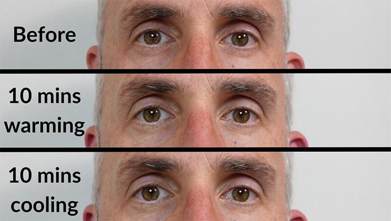 RelaxSight Pro™ Eye Massager