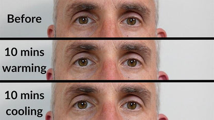 RelaxSight Pro™ Eye Massager